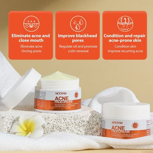 Mooyam Acne Face Cream | كريم موويام لعلاج حب الشباب